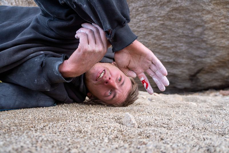 Boulderer with bleeding hand